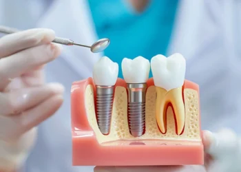 he Dental Implant Consultation Checklist: Questions To Ask Before Treatment