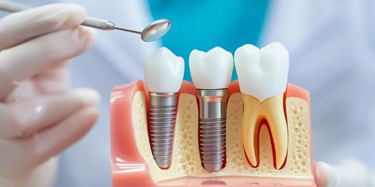 he Dental Implant Consultation Checklist: Questions To Ask Before Treatment