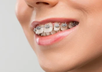 Modern Orthodontics