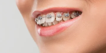 Modern Orthodontics